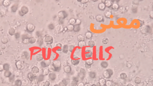 معنى pus cells